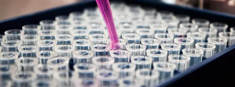 Descubre los mejores TFMs en Health Management de OBS Business School